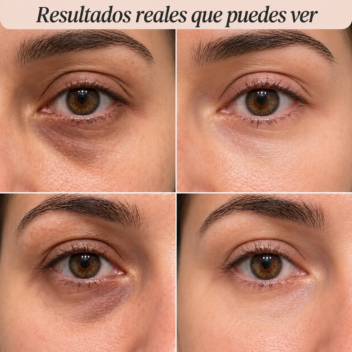 VULEM-Balsamo Adios arrugas
